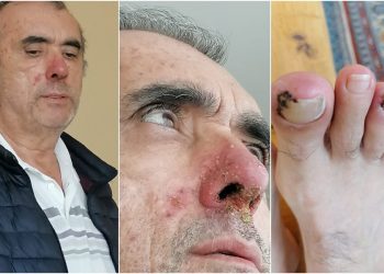 4. evre kanser hastası Ahmet Zeki Özkan’a, rapor için nakil çilesi