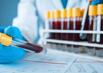 Araştırma: Ağır Covid-19 sonrası pıhtı riski normalden 290 kat fazla