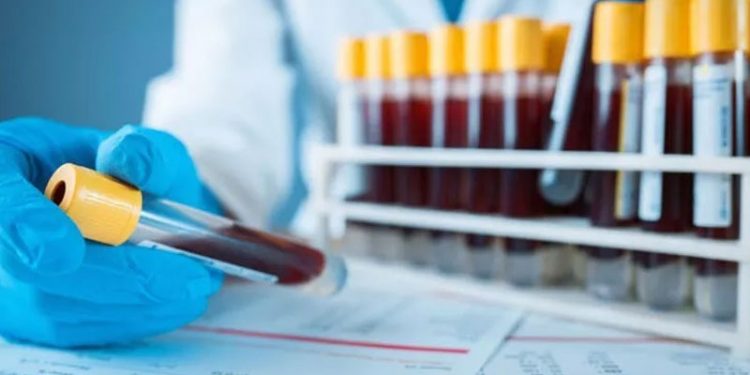 Araştırma: Ağır Covid-19 sonrası pıhtı riski normalden 290 kat fazla