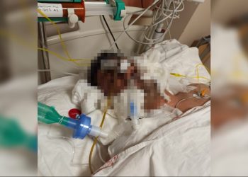 Bakanlığın ‘kalp krizinden öldü’ dediği Ferhan Yılmaz’ın yoğun bakım görüntüsü çıktı: İşkence açık