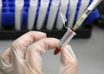 Britanya’da ortaya çıkan ‘gizemli’ virüs dünyaya yayılıyor