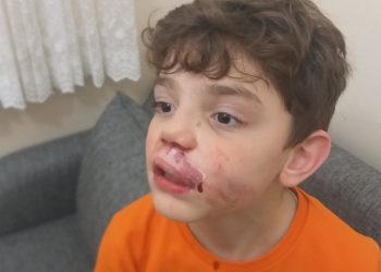 Burnu kırık ve dudağı patlak çocuğu, hastanede saatlerce beklettiler