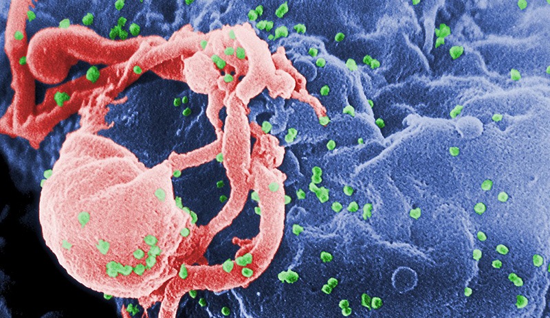 HIV enfeksiyonunun son 10 yılda yüzde 460 arttığı tek ülke Türkiye