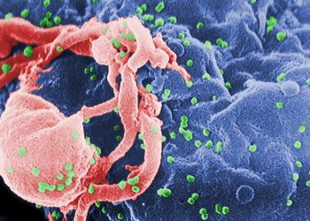 HIV enfeksiyonunun son 10 yılda yüzde 460 arttığı tek ülke Türkiye