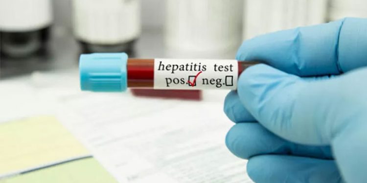 Küresel salgın riski artıyor: 'Gizemli' hepatit virüsü Kanada'da da görüldü