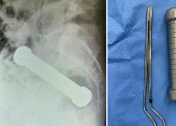 Makatına 2 kiloluk dambıl girdi!