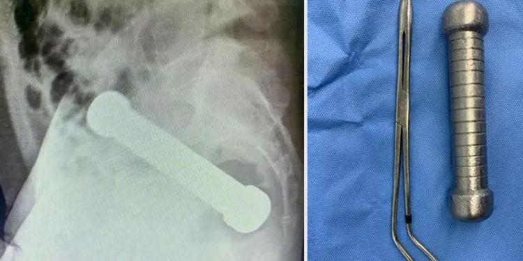 Makatına 2 kiloluk dambıl girdi!