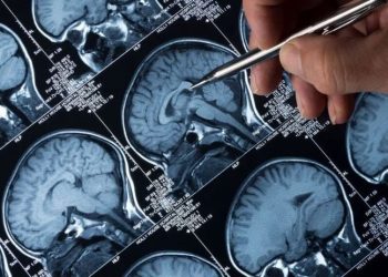 Nöroloji uzmanı profesör: Pandemi, yeni epilepsi vakalarını ortaya çıkarabilir