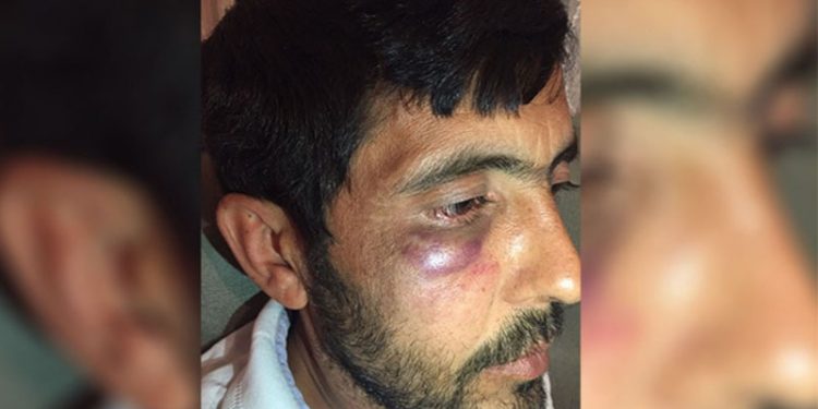 Park yeri tartışmasında 'polis şiddeti': Yüzünde morluklar oluşan yurttaş şikayetçi oldu