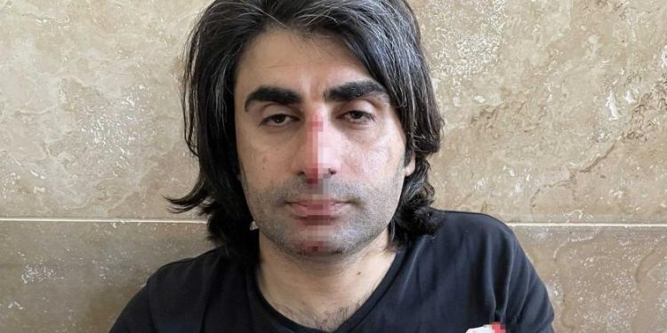 Polis adliye içinde avukata saldırdı