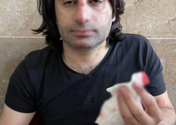 Polis işkenceye karşı çıkan avukatı adliye içinde dövdü