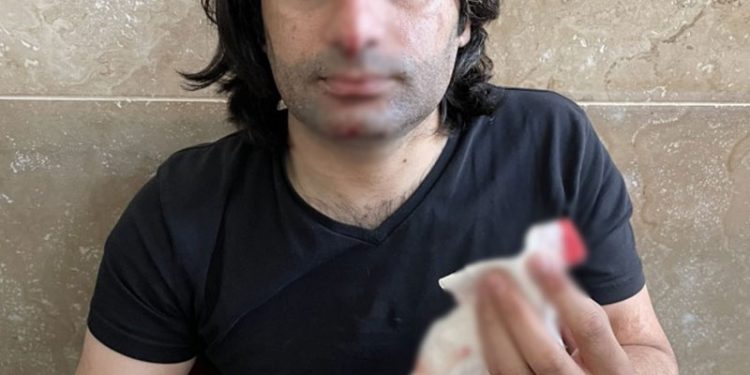 Polis işkenceye karşı çıkan avukatı adliye içinde dövdü