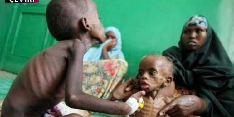 Savaş Ukrayna’yı harap etmekle kalmıyor, Somali’deki çocukları da öldürüyor