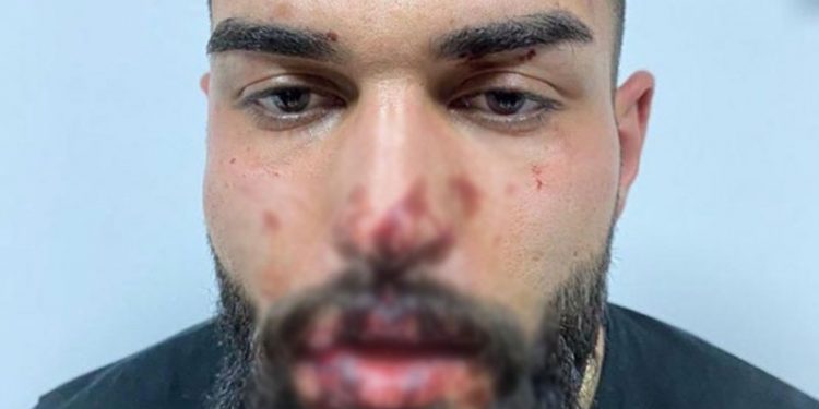 Tunceli Valiliği'nden karakolda işkenceye ilişkin açıklama