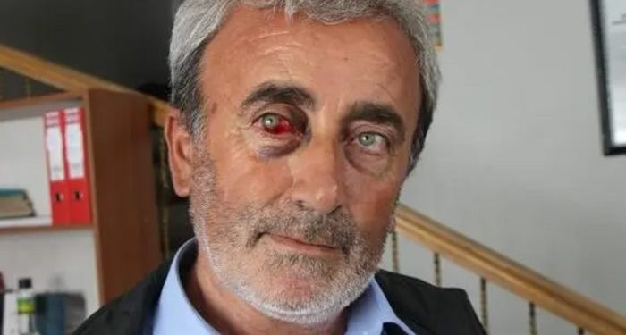 Valilik işkenceyi 20 gün sonra reddetti: ‘İthamlar jandarmanın moralini bozmaya yönelik’