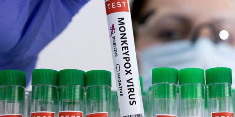 22 ülkede görülen maymun çiçeği virüsüne Türkiye hazır mı?