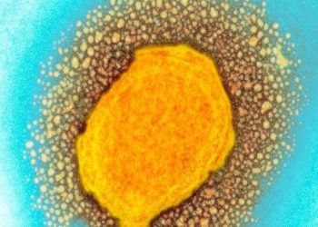 9 maddede 'maymun çiçeği virüsü' nedir?