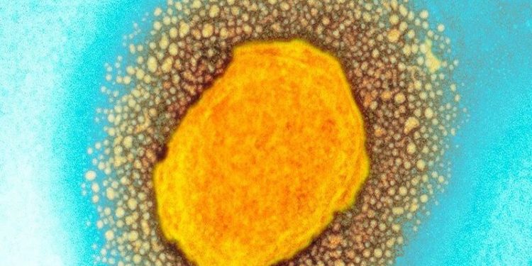 9 maddede 'maymun çiçeği virüsü' nedir?