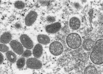 Avrupa'nın ardından ABD'de de maymun çiçeği virüsü görüldü