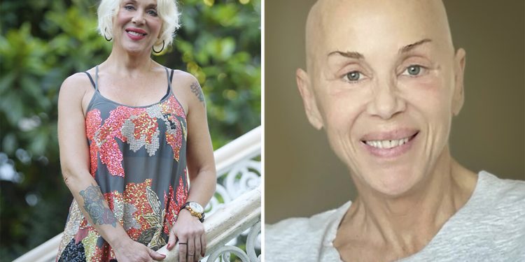 Billur Kalkavan: Kanser olunca isyan etmedim, kendimi sorguladım