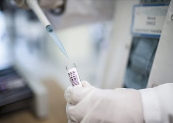 Bir ülkede daha maymun çiçeği virüsü görüldü