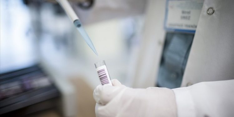 Bir ülkede daha maymun çiçeği virüsü görüldü