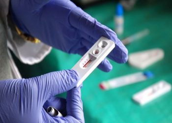 Covid-19 için kullanılan hızlı testler, cinsel yolla bulaşan hastalıklar için de kullanılabilir