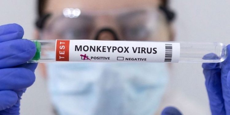 Fransa'da 16 kişide maymun çiçeği virüsü tespit edildi