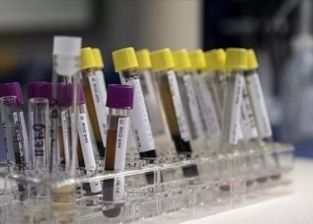 Gizemli hepatit vakaları 228'e yükseldi