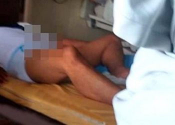 Kadınların beğendiği kocasını kıskandı, uyurken cinsel organını kesti!