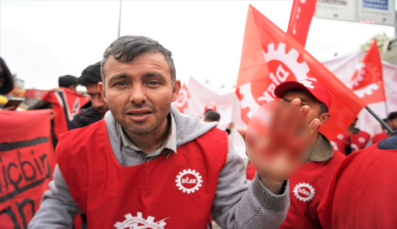 Kafasından darbe alan işçi: Polis telsizle kafamıza vurdu