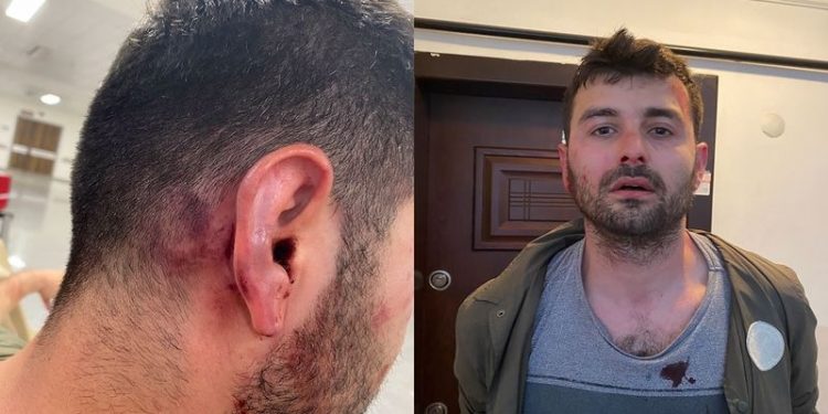 Kiracısının burnunu kırdı: Evden çık!