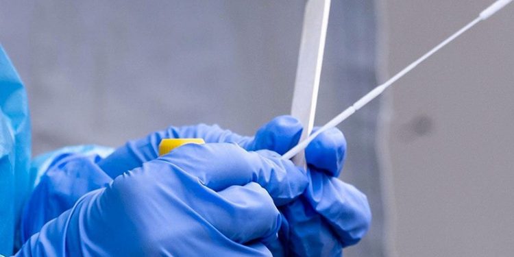 Koronavirüste bugün: 11 kişi hayatını kaybetti; bin 661 kişi pozitif çıktı