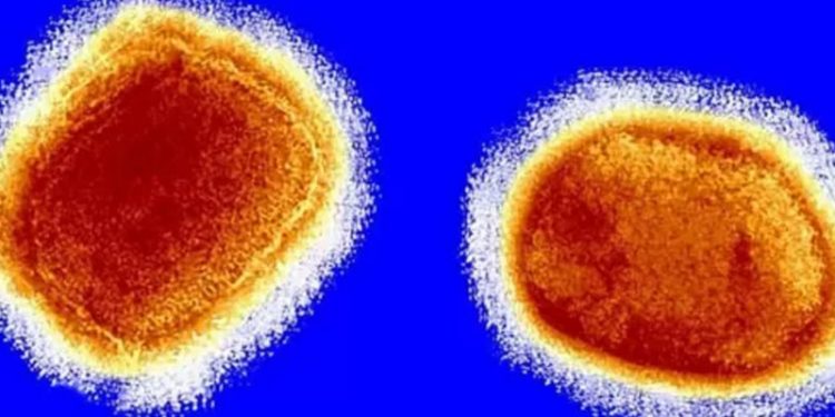 Maymun çiçeği virüsü: Dünya Sağlık Örgütü 'Vakalar artabilir ancak endişeye kapılmamak gerek' diyor