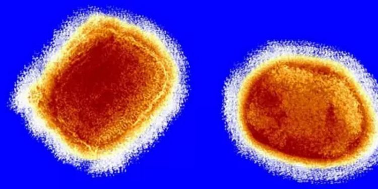 Maymun çiçeği virüsü: Üç ülkede daha yeni vakalar tespit edildi