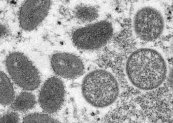 Maymun çiçeği virüsü: İngiltere'de semptomlu kişilere cinsel ilişkiden uzak durmaları tavsiye edildi