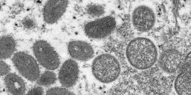 Maymun çiçeği virüsü: İngiltere'de semptomlu kişilere cinsel ilişkiden uzak durmaları tavsiye edildi