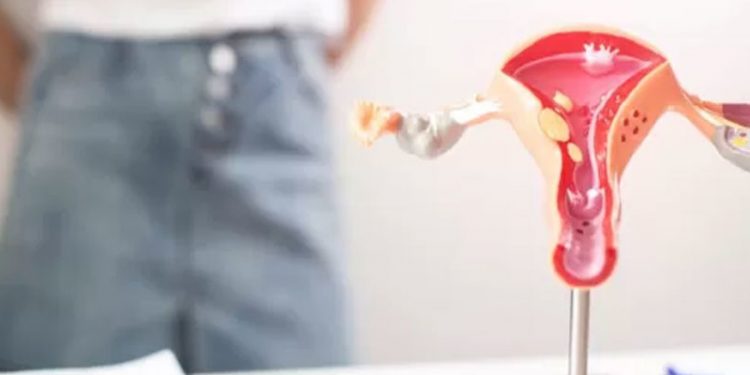 Regl izni: Hangi ülkelerde uygulanıyor, kadınların deneyimleri neler?