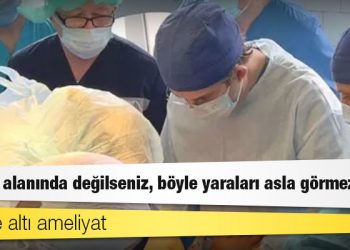 Ukrayna'da hayat kurtaran Suriyeli doktor: 'Savaş alanında değilseniz, böyle yaraları asla görmezsiniz'