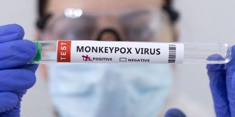 İspanya'da maymun çiçeği tespit edilenlerin sayısı 51'e çıktı