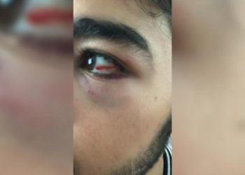 İstanbul'da 3 Arap asıllı &ccedil;ocuk saldırıya uğradı