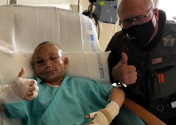 9 yaşındaki kız çocuk, saklambaç oynarken 'dağ aslanı' saldırısına uğradı