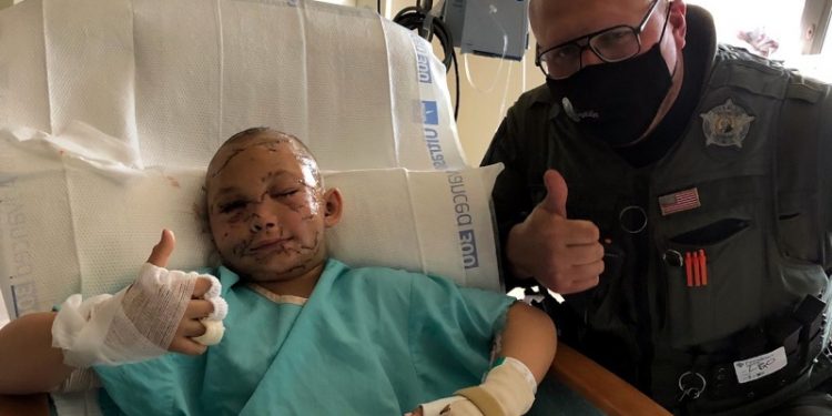 9 yaşındaki kız çocuk, saklambaç oynarken 'dağ aslanı' saldırısına uğradı