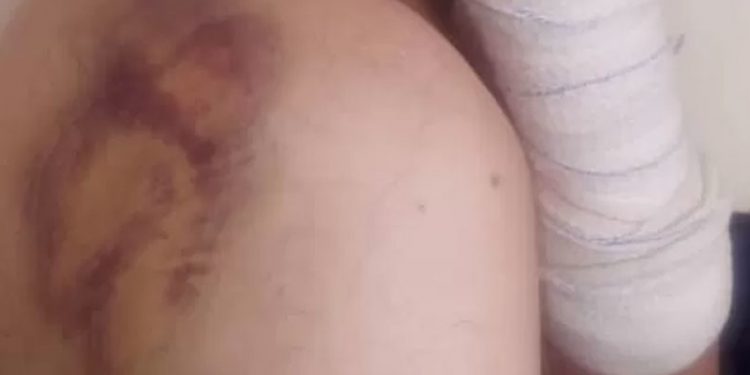 Afganistan’daki İngiltere elçiliği çalışanları Taliban’ın kendilerine işkence ettiğini anlatıyor