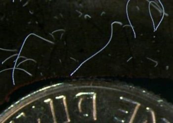 Bu bakteri gözle görülebiliyor