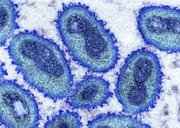 Maymun çiçeği virüsü: Afrika dışındaki vaka sayısı üçe katlanarak 780’e yükseldi