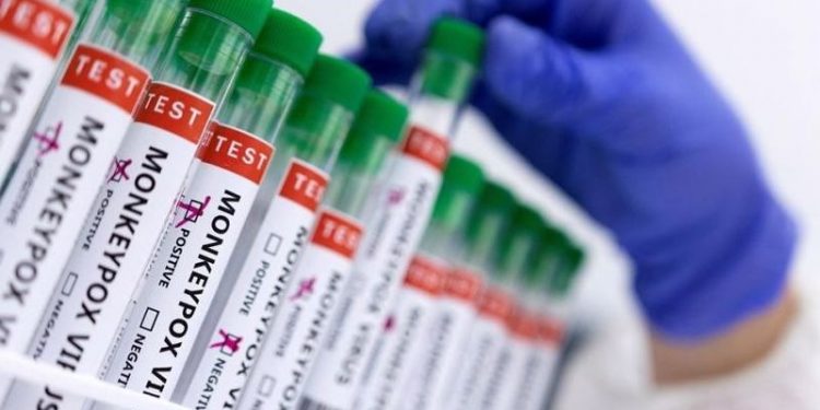 Nijerya maymun çiçeği yayılımını engellemek için vahşi hayvan eti satışını yasakladı