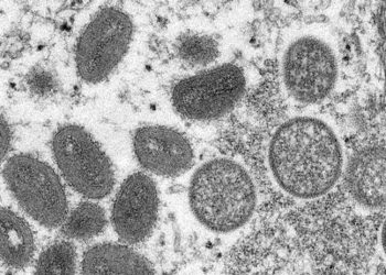 Nijerya'da ‘maymun çiçeği’ alarmı: Bir haftada 10 kişide görüldü