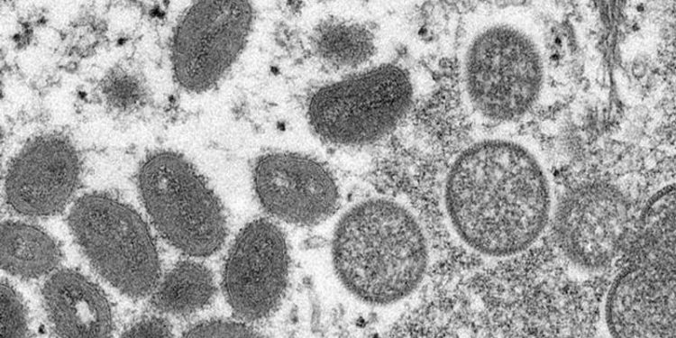 Nijerya'da ‘maymun çiçeği’ alarmı: Bir haftada 10 kişide görüldü