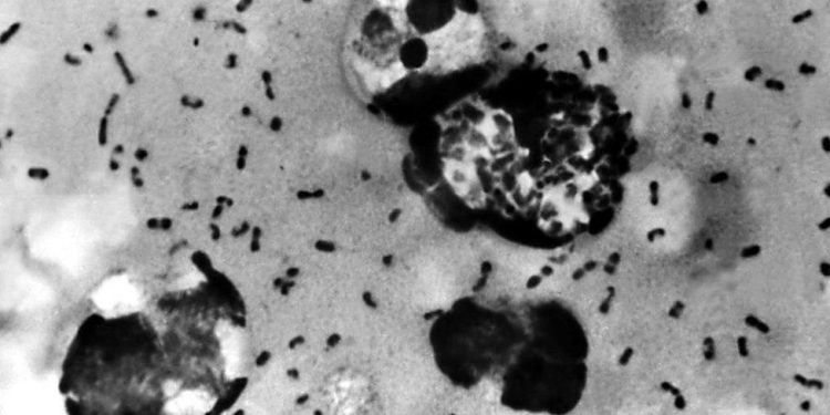 On milyonlarca insan hayatını kaybetmişti; araştırmacılar 14'üncü yüzyılın büyük salgını Kara Veba'nın çıktığı yeri tespit etti